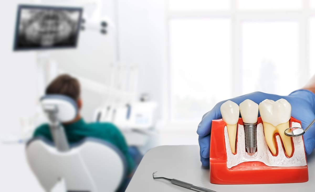 Restorative Dentistry in Bellevue