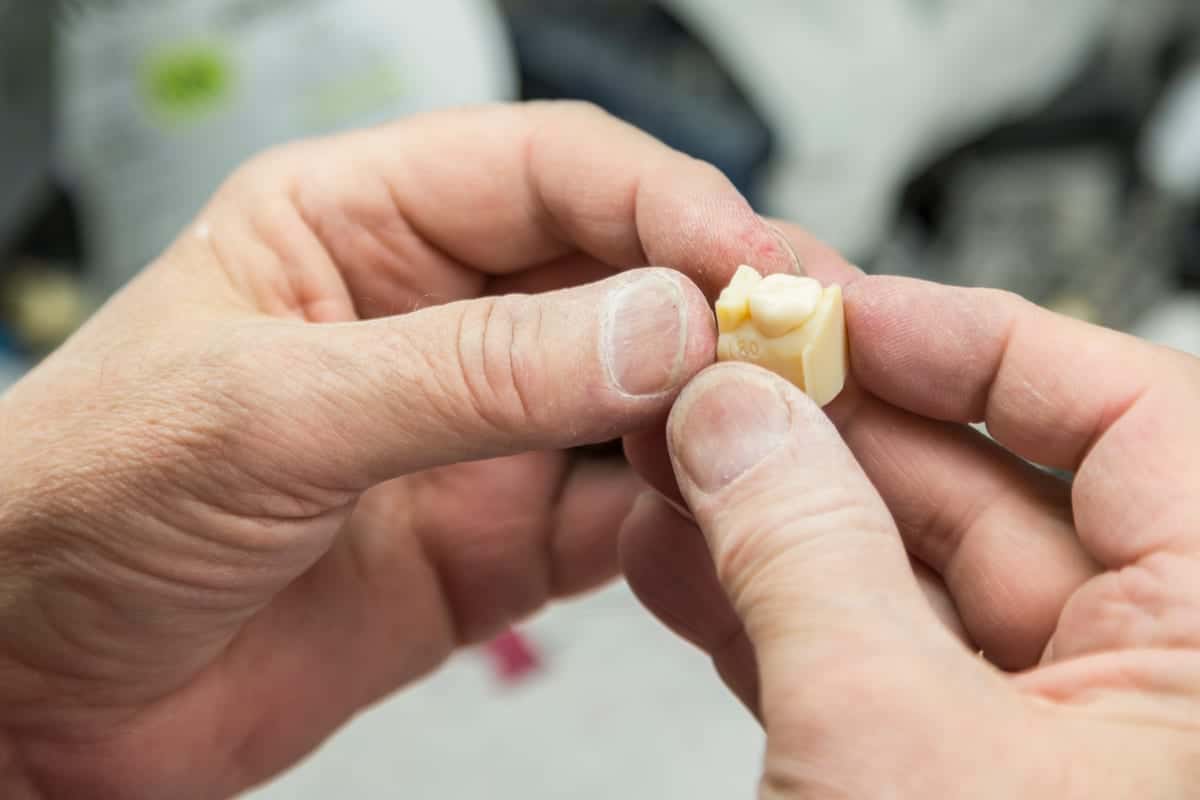 Dental Crowns in Bellevue
