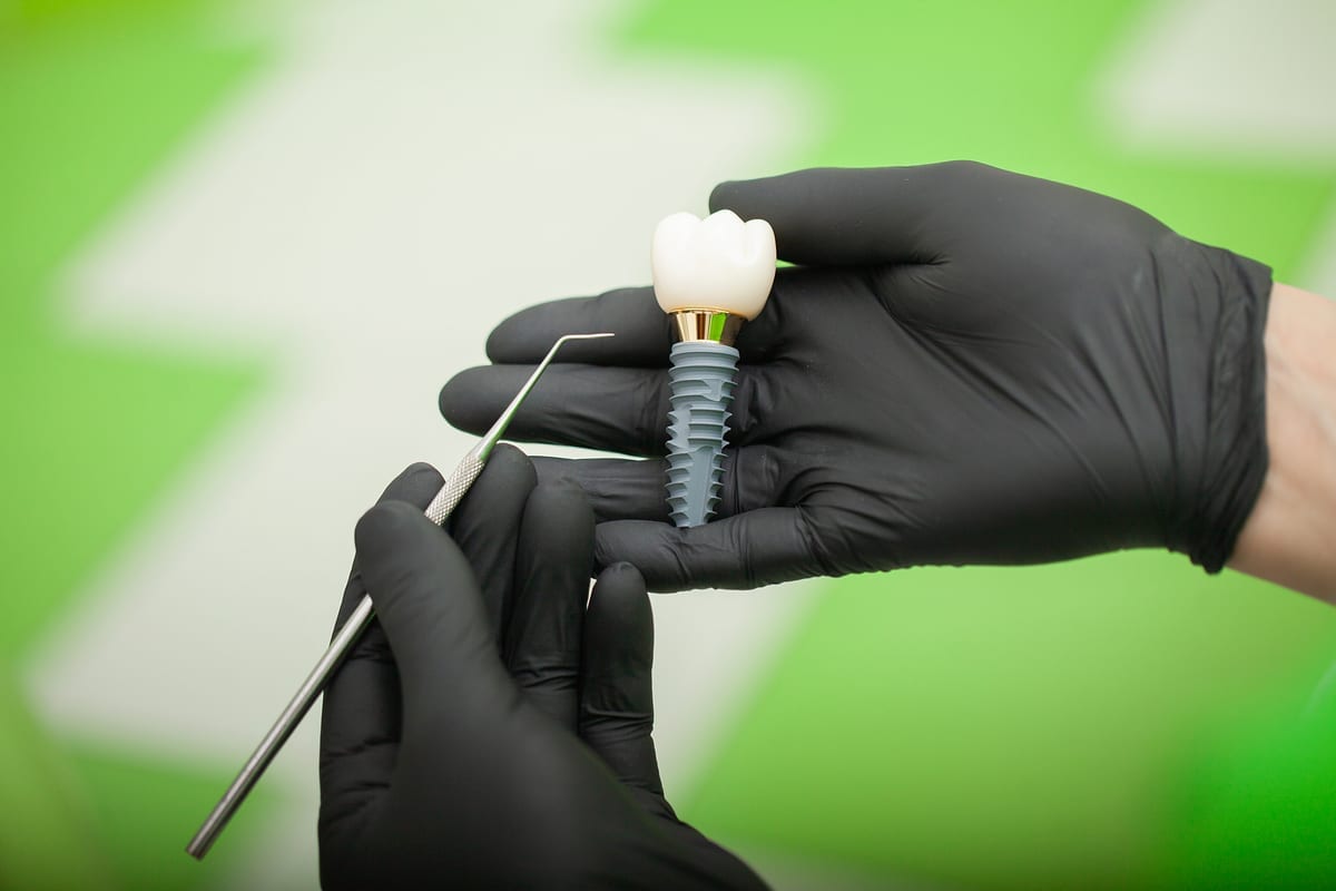 Dental Implants in Bellevue